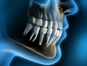 Microbiología Oral (Alta Especialidad Implantología)